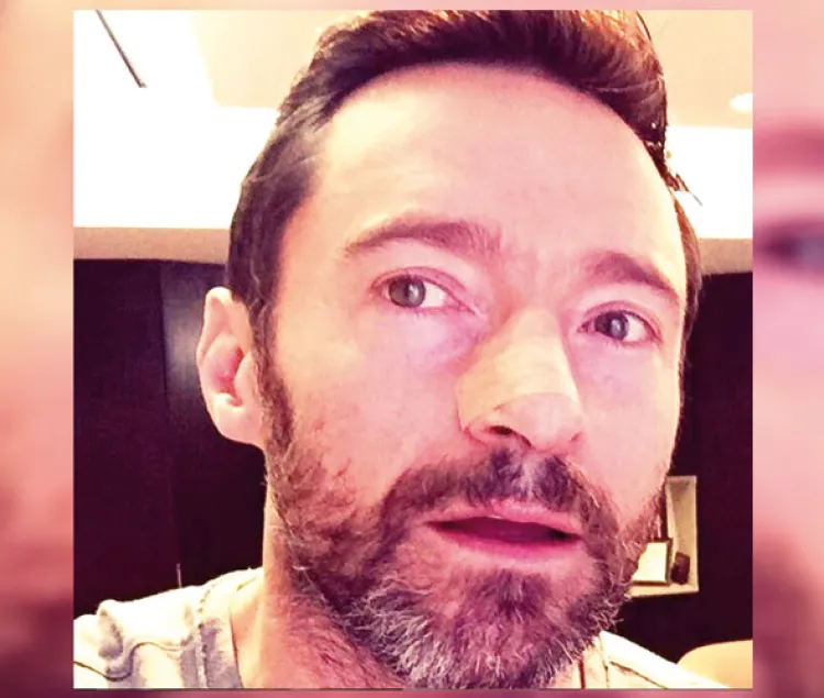 Recibe Hugh Jackman otro tratamiento vs cáncer de piel