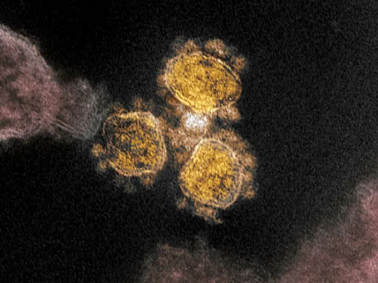 Exige Japón ampliar investigaciones sobre origen del coronavirus