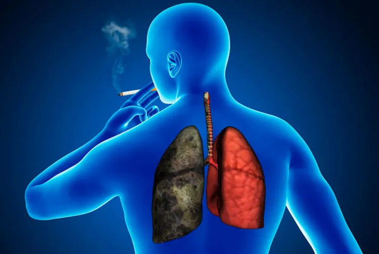 ¿Sólo les da a fumadores? Estos son los síntomas del cáncer de pulmón