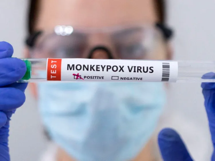Reporta OMS alza mundial en casos de viruela del mono