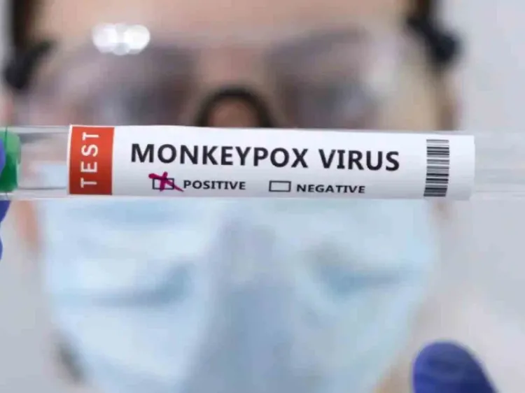 Pide OMS respuesta “urgente” de Europa ante aumento de casos de viruela del mono