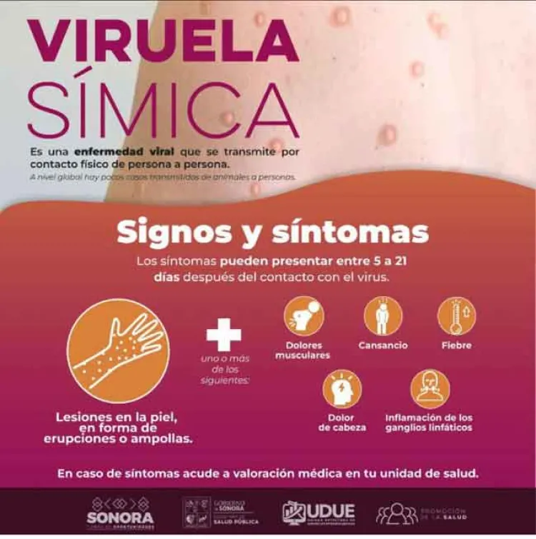 Confirman 2 casos de viruela símica en Sonora