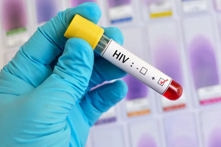 Aumentan contagios de VIH entre jóvenes