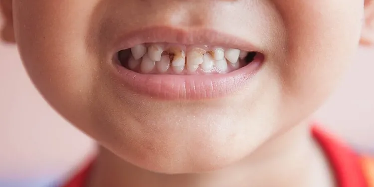 Salud dental influye en autoestima de niños y jóvenes