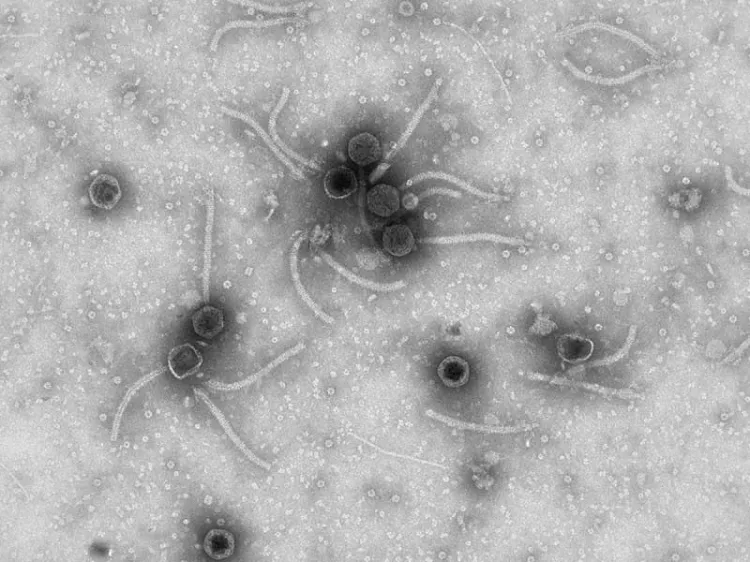 Científicos descubren nuevo virus en el fondo de la Fosa de las Marianas