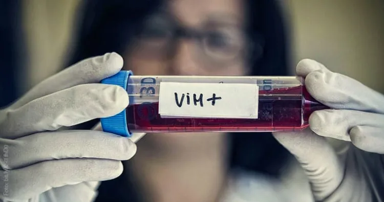 IMSS atiende a 111 mil pacientes con VIH en el país